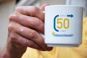 Plaque Psoriasis in 2025: Oral Therapy Insights & Seasonal Skin Care Strategies preview